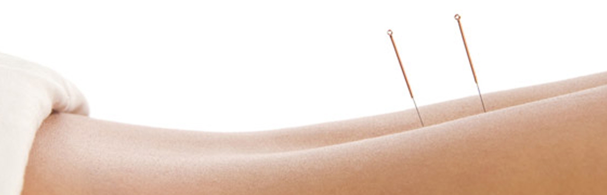 Myofasciale therapie (dry needling)